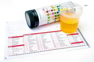 UTI (Urinary Tract Infection) in Children